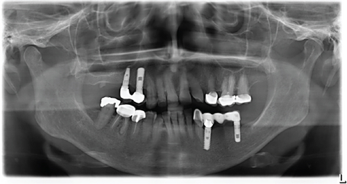 Details are in the caption following the image