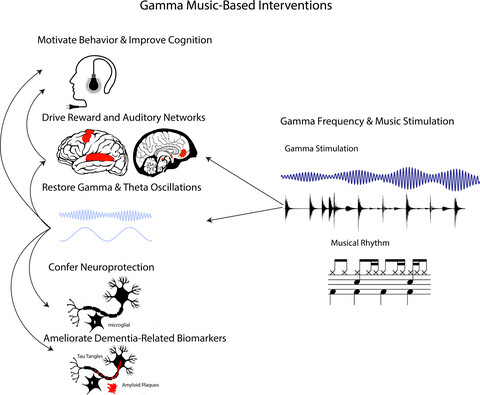 Integrating music-based interventions with Gamma-frequency stimulation: Implications for healthy ageing