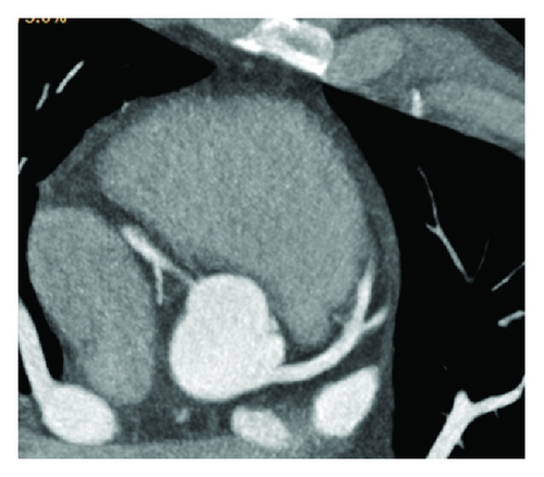 Details are in the caption following the image