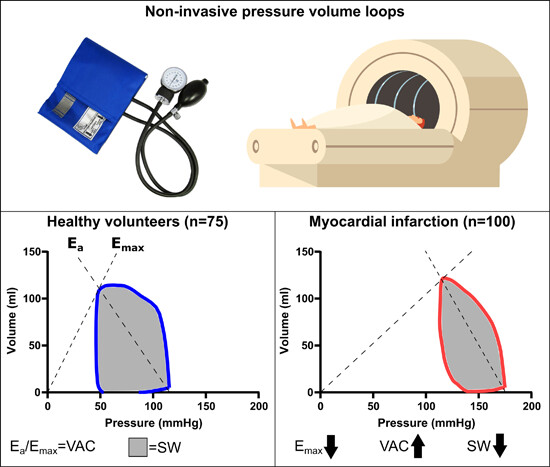 Contractility, ventriculoarterial coupling, and stroke work after acute myocardial infarction using CMR-derived pressure-volume loop data