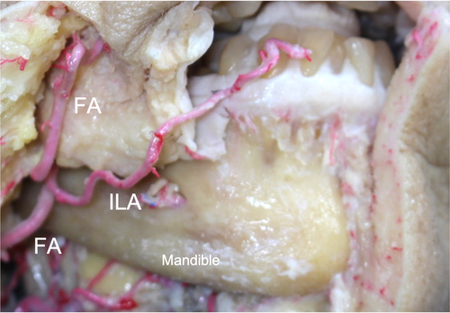 Details are in the caption following the image