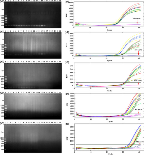 Compared with conventional PCR assay, qPCR assay greatly improves the detection efficiency of predation
