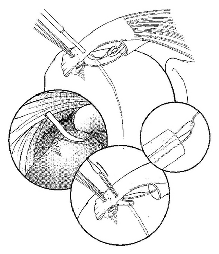 Details are in the caption following the image