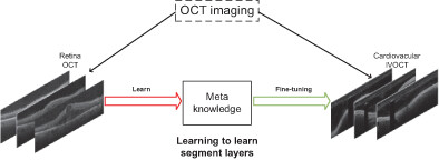 Automatic lumen and anatomical layers segmentation in IVOCT images using meta learning