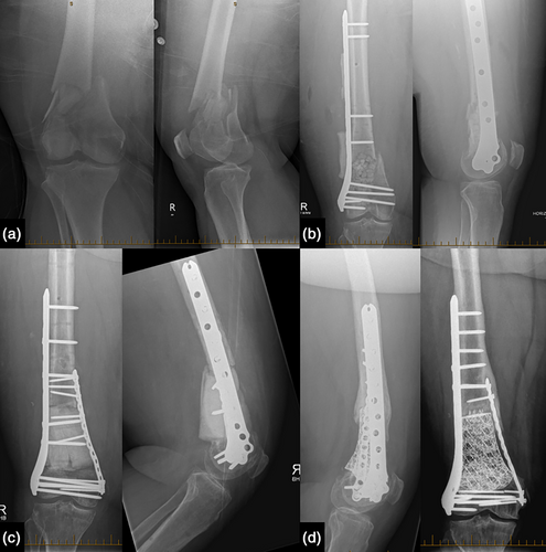 Details are in the caption following the image Details are in the caption following the image