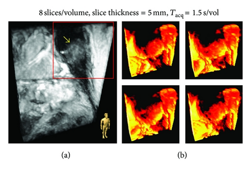 Details are in the caption following the image Details are in the caption following the image