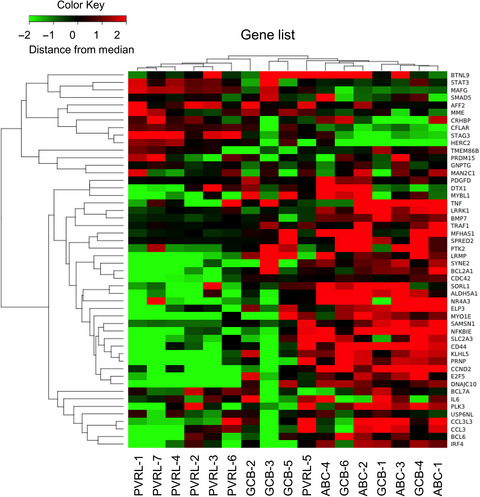 Gene expression profiling of primary vitreoretinal lymphoma