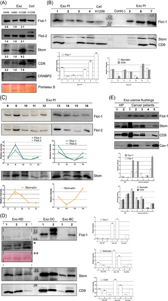 Stomatin is highly expressed in exosomes of different origin and is a promising candidate as an exosomal marker