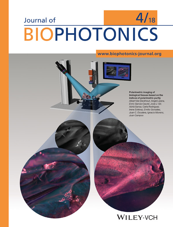 Inside Cover: Polarimetric imaging of biological tissues based on the indices of polarimetric purity (J. Biophotonics 4/2018)