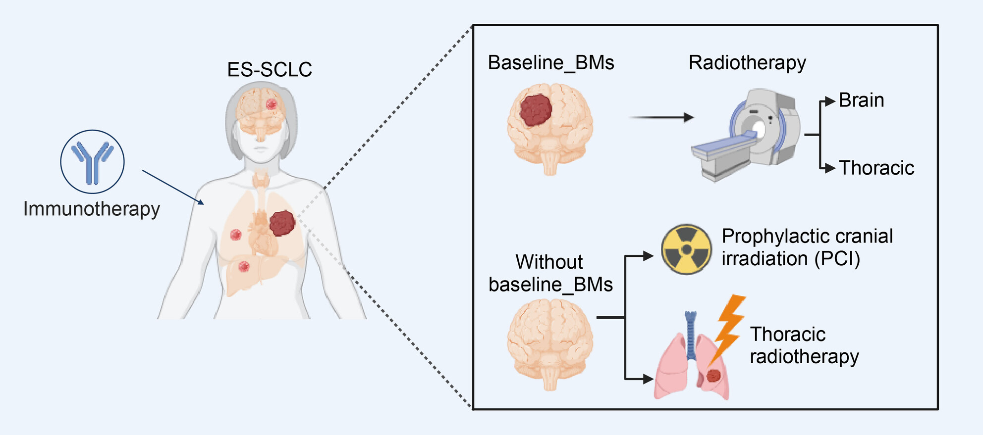 The Optimal Radiotherapy Strategy for Patients With Small Cell Lung Cancer and Brain Metastasis: A Retrospective Analysis