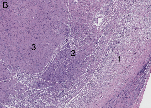Details are in the caption following the image Details are in the caption following the image