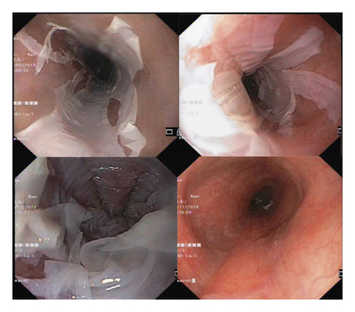 Details are in the caption following the image Details are in the caption following the image