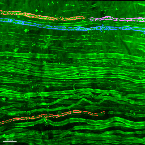 Label-free non-linear microscopy to measure myelin outcome in a rodent model of Charcot-Marie-Tooth diseases