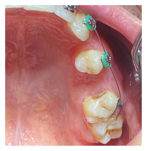 Details are in the caption following the image Details are in the caption following the image