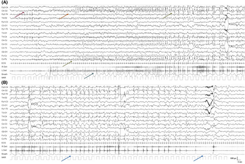 Details are in the caption following the image Details are in the caption following the image