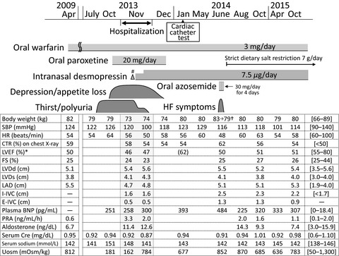 A case of central diabetes insipidus associated with cardiac dysfunction
