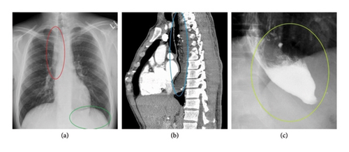 Details are in the caption following the image Details are in the caption following the image