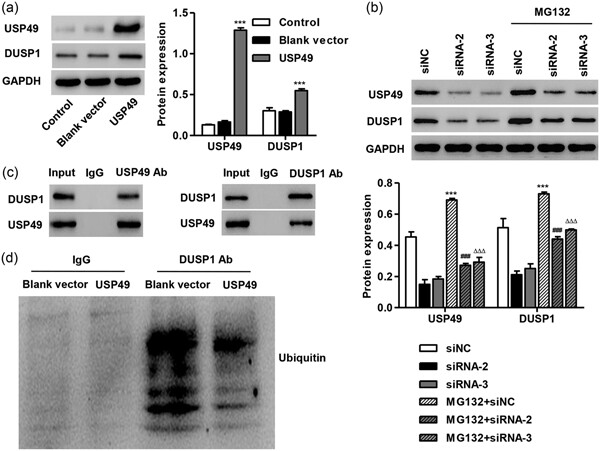 USP49 inhibits ischemia–reperfusion-induced cell viability suppression and apoptosis in human AC16 cardiomyocytes through DUSP1–JNK1/2 signaling