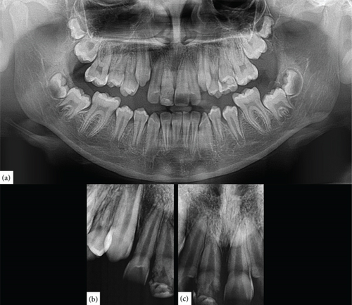Details are in the caption following the image