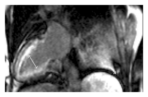 Details are in the caption following the image