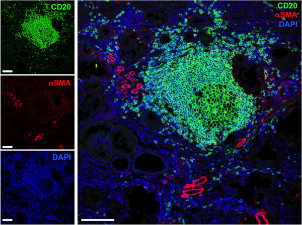 Long-term B cell depletion associates with regeneration of kidney function