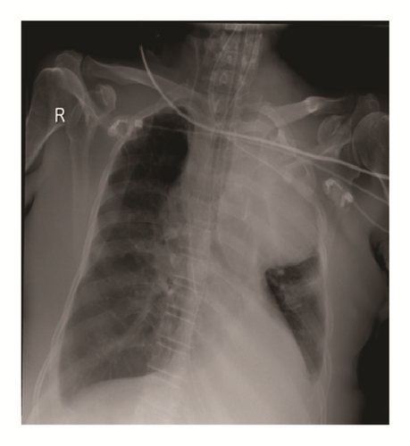 Details are in the caption following the image