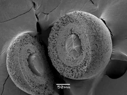 One-Step Fabrication of Triple-Layered Polymeric Microparticles with Layer Localization of Drugs as a Novel Drug-Delivery System