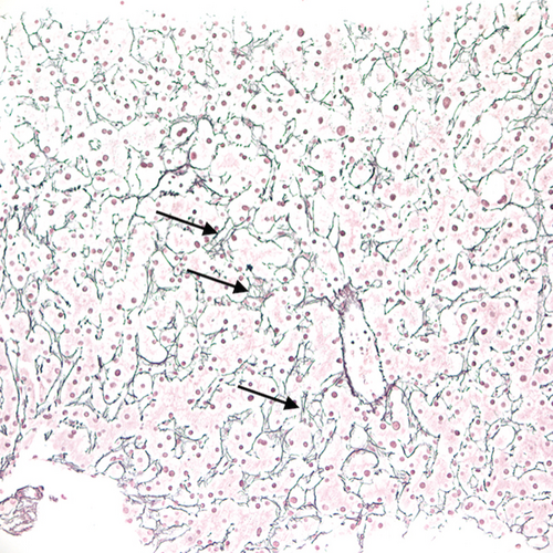 Details are in the caption following the image
