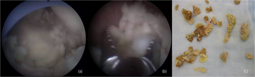 Details are in the caption following the image Details are in the caption following the image
