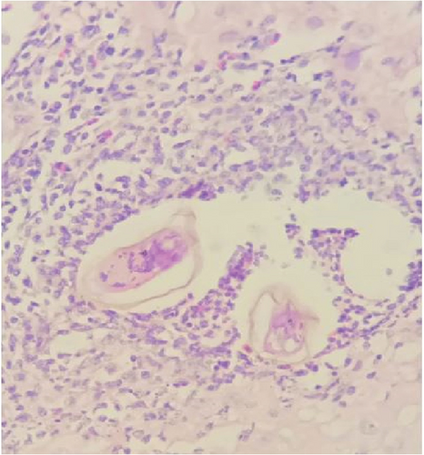Details are in the caption following the image