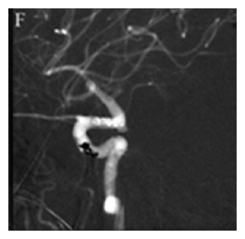 Details are in the caption following the image