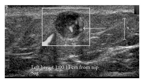 Details are in the caption following the image