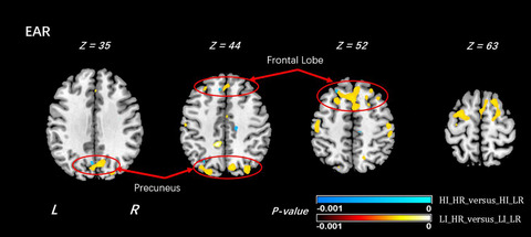 A diffusion tensor imaging study of brain microstructural changes related to religion and spirituality in families at high risk for depression