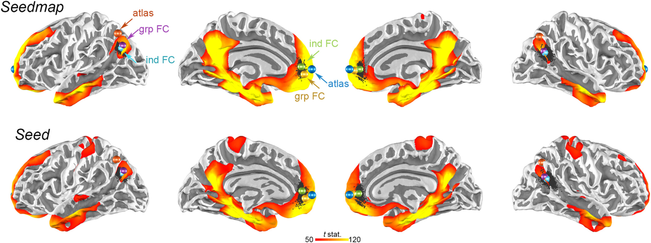 Identification of Cortical Targets for Modulating Function Supported by the Human Hippocampal Network