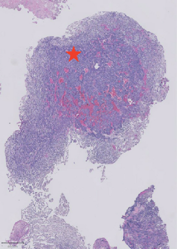 Details are in the caption following the image