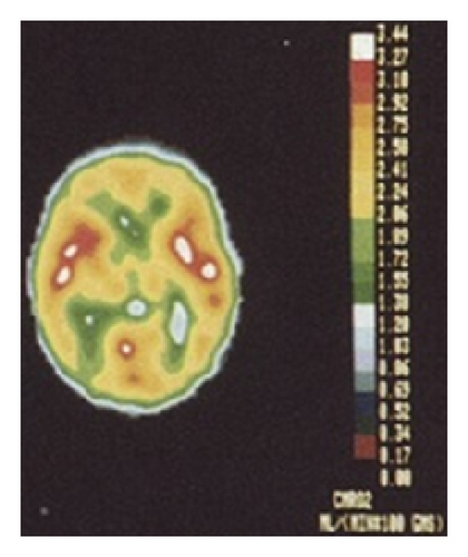 Details are in the caption following the image