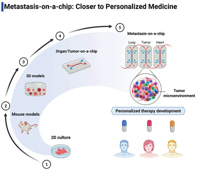 Evolution of Metastasis Study Models toward Metastasis-On-A-Chip: The Ultimate Model?