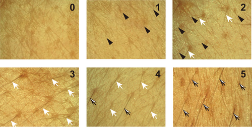 Details are in the caption following the image Details are in the caption following the image