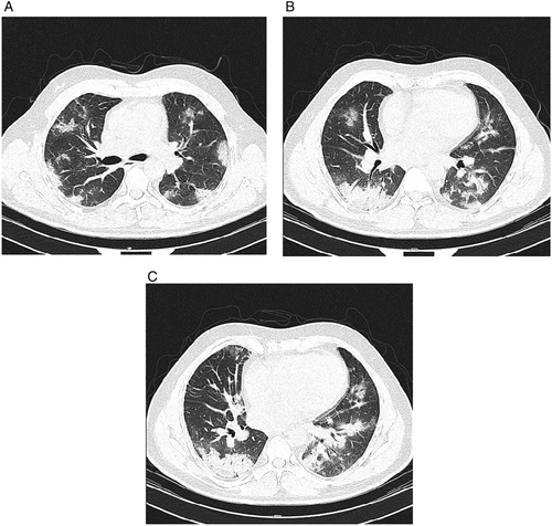 Details are in the caption following the image Details are in the caption following the image