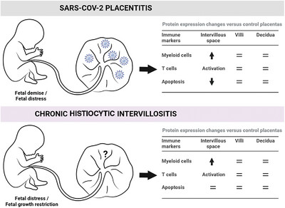 Similar Spatial Expression of Immune-Related Proteins in SARS-CoV-2 Placentitis and Chronic Histiocytic Intervillositis
