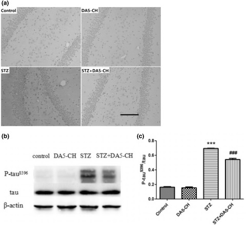 The novel GLP-1/GIP analogue DA5-CH reduces tau phosphorylation and normalizes theta rhythm in the icv. STZ rat model of AD