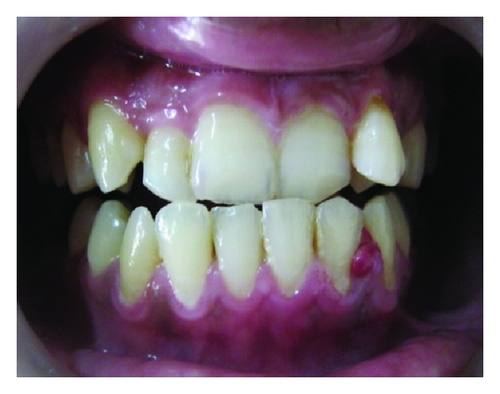 Details are in the caption following the image Details are in the caption following the image