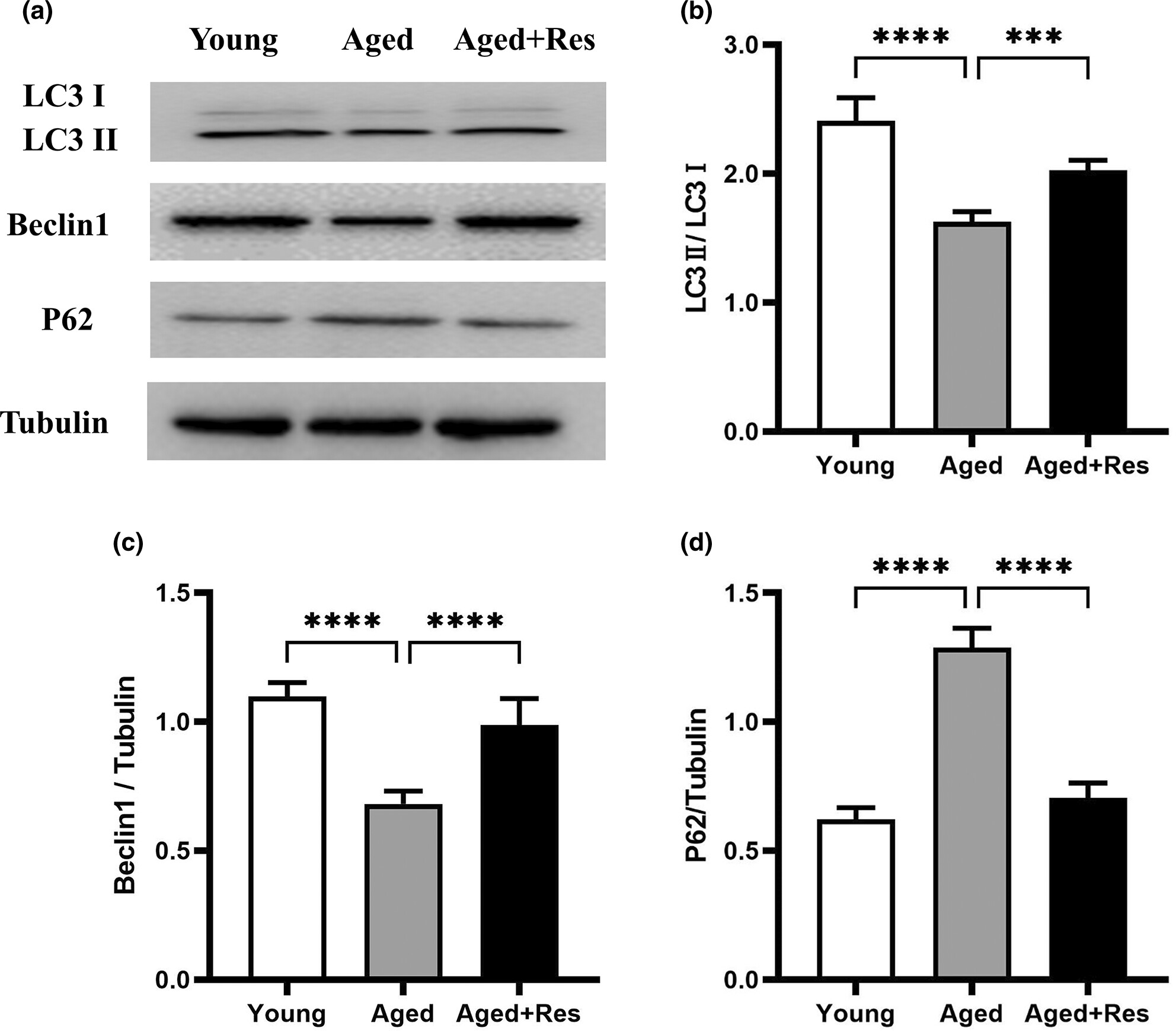 Effects of resveratrol on tolerance to ischemia/reperfusion injury in aged male mice: Role of autophagy and apoptosis