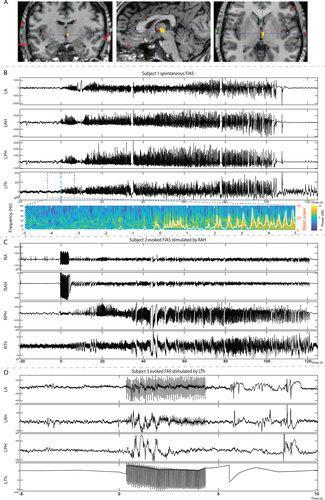 Details are in the caption following the image Details are in the caption following the image