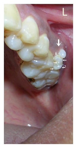 Details are in the caption following the image