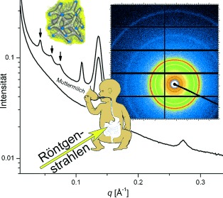 Self-Assembly Structure Formation during the Digestion of Human Breast Milk
