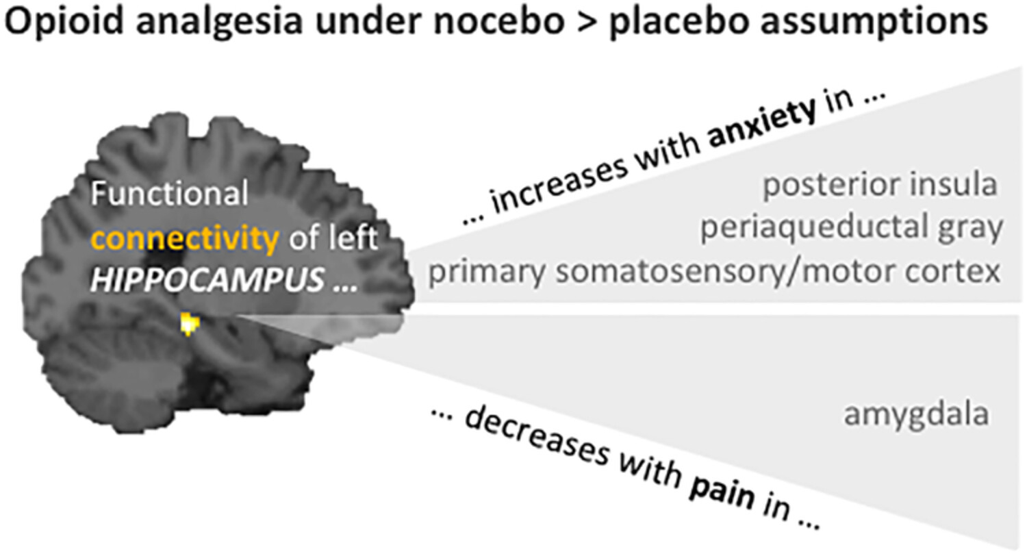 Hippocampus mediates nocebo impairment of opioid analgesia through changes in functional connectivity
