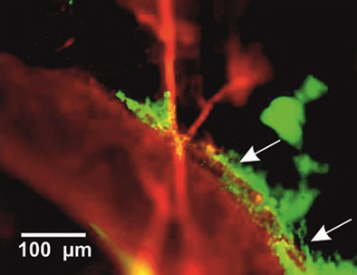 Photodynamic opening of the blood-brain barrier and pathways of brain clearing