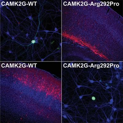 The intellectual disability-associated CAMK2G p.Arg292Pro mutation acts as a pathogenic gain-of-function