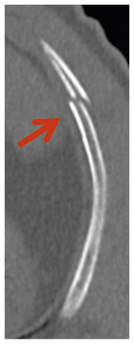 Details are in the caption following the image